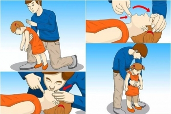 Thủ thuật Heimlich để sơ cứu khi trẻ hóc dị vật.